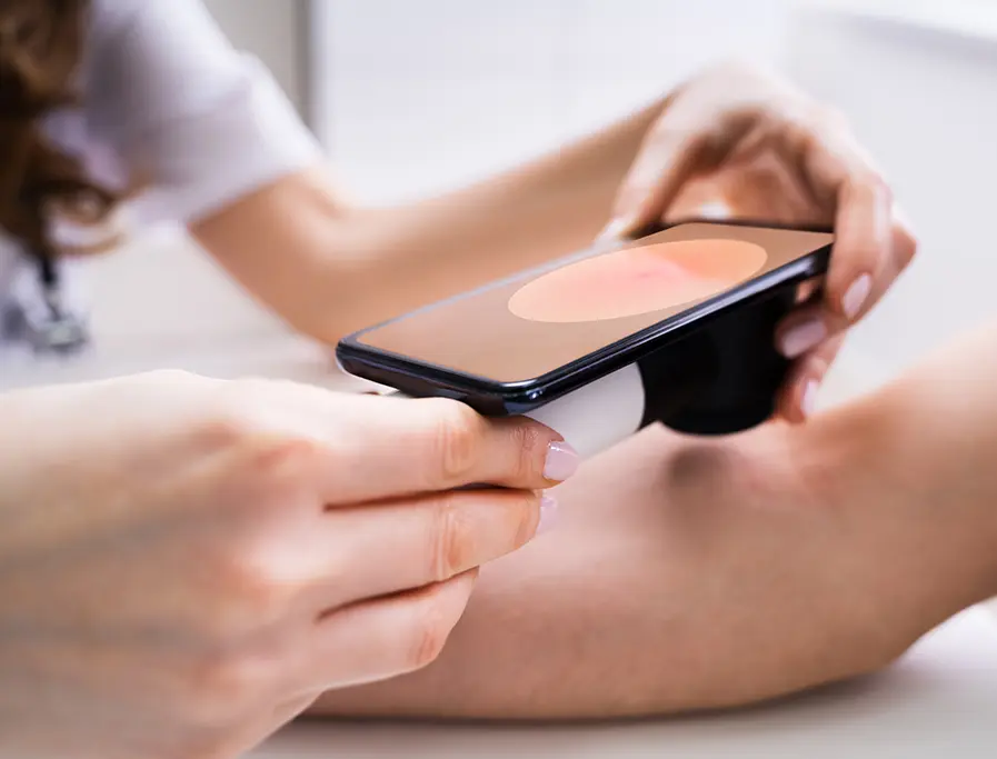 Mobile Dermoscopy – Skin Health Check Bondi Junction, Randwick & Sydney CBD